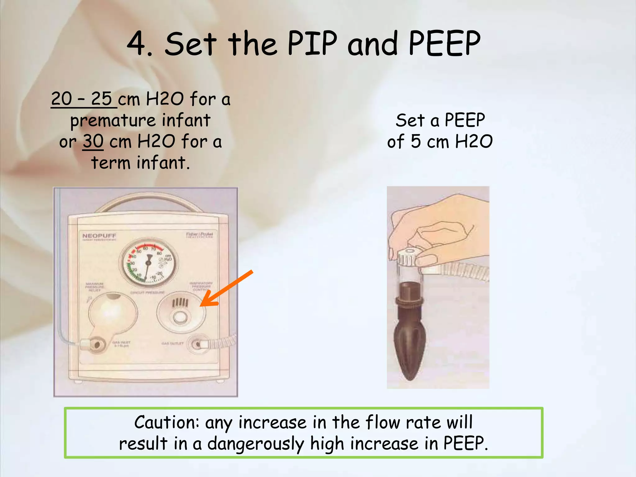 4. Set the PIP and PEEP
20 – 25 cm H2O for a
premature infant
or 30 cm H2O for a
term infant.
Set a PEEP
of 5 cm H2O
Caution: any increase in the flow rate will
result in a dangerously high increase in PEEP.
 