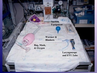 Suction
Equipment

Warmer &
Blankets
Bag, Mask,
& Oxygen
Laryngoscope
and ETT Tube

 