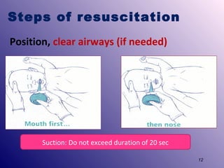 Steps of resuscitation
Position, clear airways (if needed)

Suction: Do not exceed duration of 20 sec
12

 