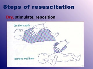 Steps of resuscitation
Dry, stimulate, reposition

13

 