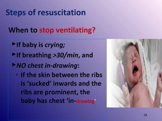 Steps of resuscitation
When to stop ventilating?
If baby is crying;
If breathing >30/min, and
NO chest in-drawing:
◦ If the skin between the ribs
is ‘sucked’ inwards and the
ribs are prominent, the
baby has chest ‘in-drawing’
19

 
