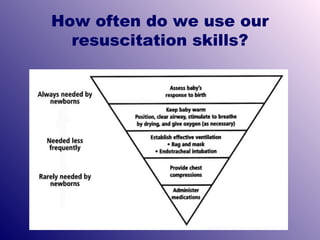 How often do we use our
resuscitation skills?

 