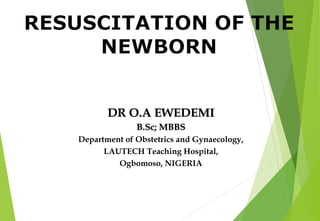DR O.A EWEDEMIDR O.A EWEDEMI
B.Sc; MBBSB.Sc; MBBS
Department of Obstetrics and Gynaecology,
LAUTECH Teaching Hospital,
Ogbomoso, NIGERIA
 