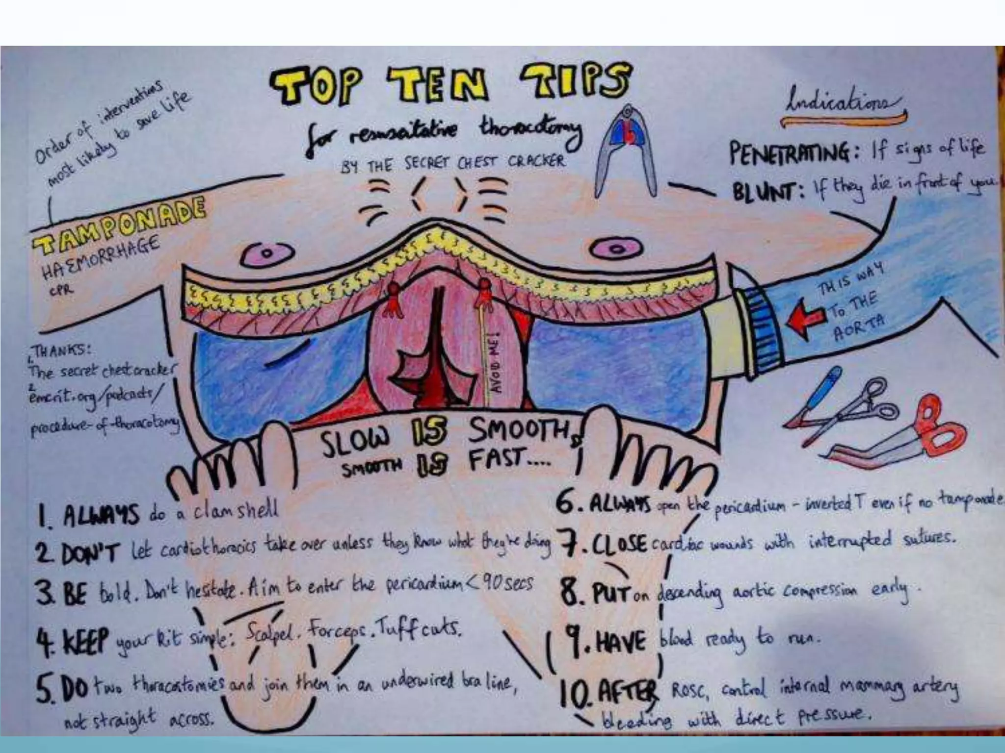 Resuscitative Thoracotomy
