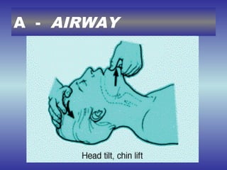 A - AIRWAY
 
