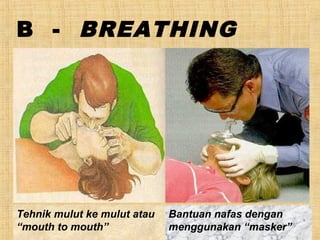 B - BREATHING
Tehnik mulut ke mulut atau
“mouth to mouth”
Bantuan nafas dengan
menggunakan “masker”
 