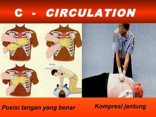 C - CIRCULATION
Posisi tangan yang benar Kompresi jantung
 