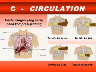 C - CIRCULATION
Terlalu ke kanan Terlalu ke kiri
Terlalu ke bawahTerlalu ke atas
Posisi tangan yang salah
pada kompresi jantung
 