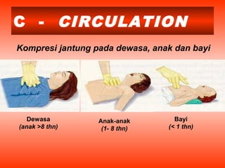 C - CIRCULATION
Kompresi jantung pada dewasa, anak dan bayi
Dewasa
(anak >8 thn)
Anak-anak
(1- 8 thn)
Bayi
(< 1 thn)
 