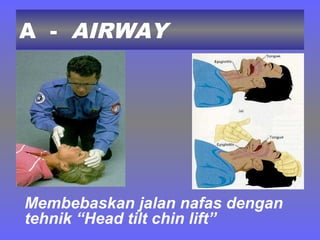 A - AIRWAY
Membebaskan jalan nafas dengan
tehnik “Head tilt chin lift”
 