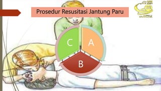Prosedur Resusitasi Jantung Paru
A
B
C