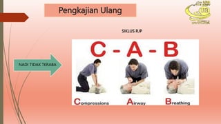 Pengkajian Ulang
SIKLUS RJP
NADI TIDAK TERABA