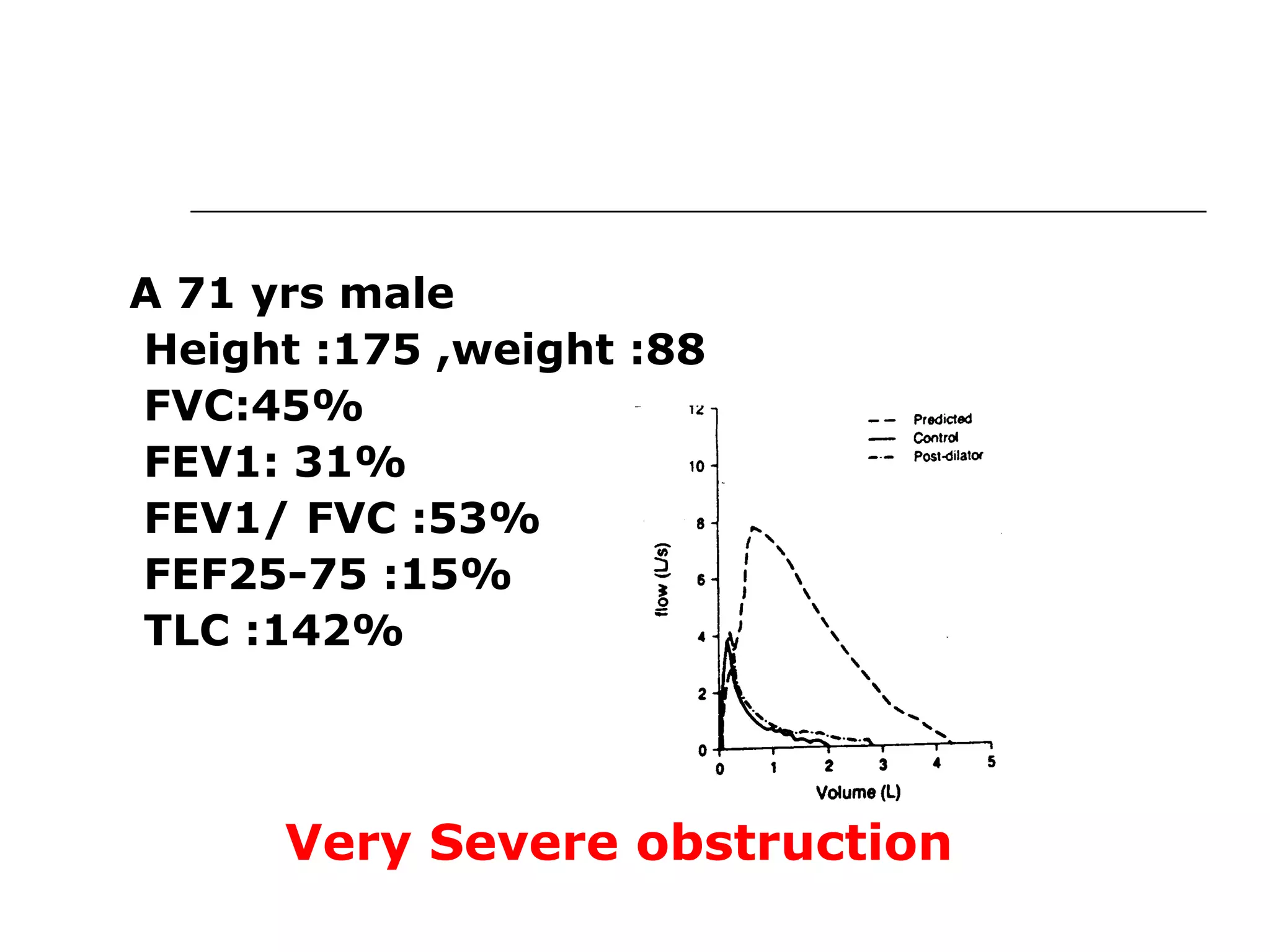 A 71 yrs male 
Height :175 ,weight :88 
FVC:45% 
FEV1: 31% 
FEV1/ FVC :53% 
FEF25-75 :15% 
TLC :142% 
Very Severe obstruction 
 