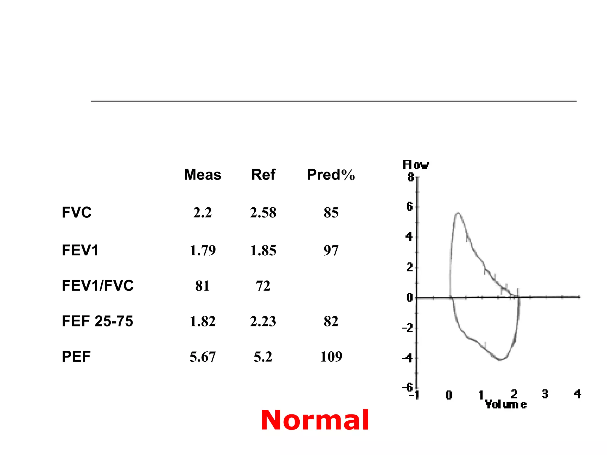 Meas Ref Pred% 
FVC 2.2 2.58 85 
FEV1 1.79 1.85 97 
FEV1/FVC 81 72 
FEF 25-75 1.82 2.23 82 
PEF 5.67 5.2 109 
Normal 
 