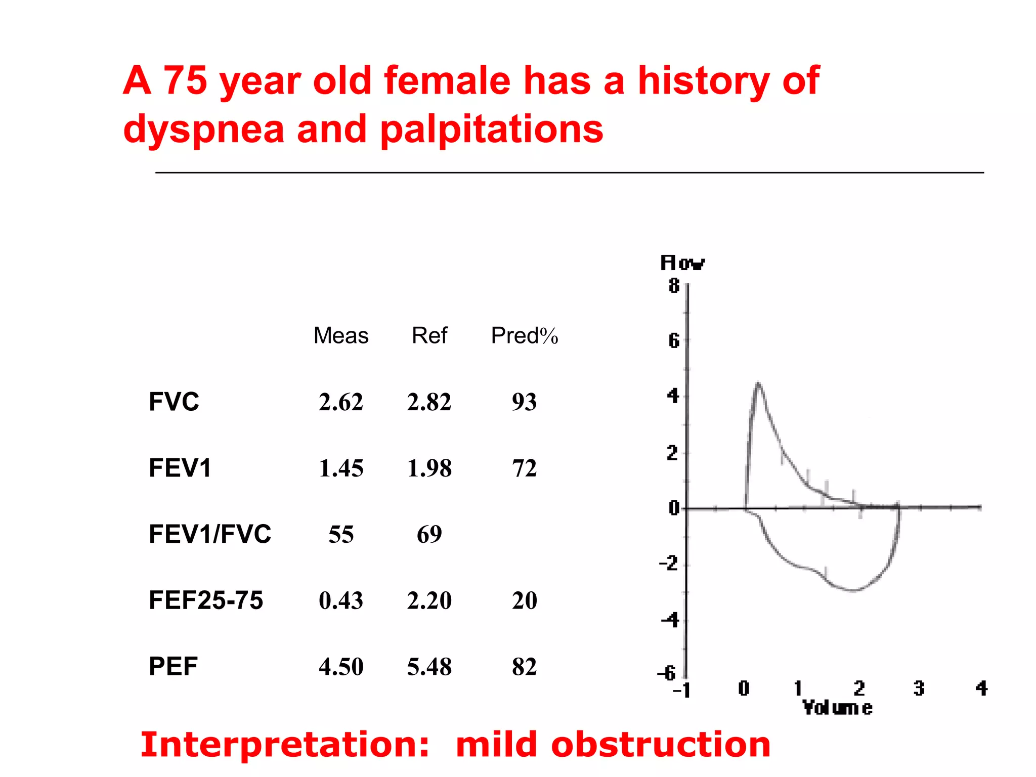 A 75 year old female has a history of 
dyspnea and palpitations 
Meas Ref Pred% 
FVC 2.62 2.82 93 
FEV1 1.45 1.98 72 
FEV1/FVC 55 69 
FEF25-75 0.43 2.20 20 
PEF 4.50 5.48 82 
Interpretation: mild obstruction 
 