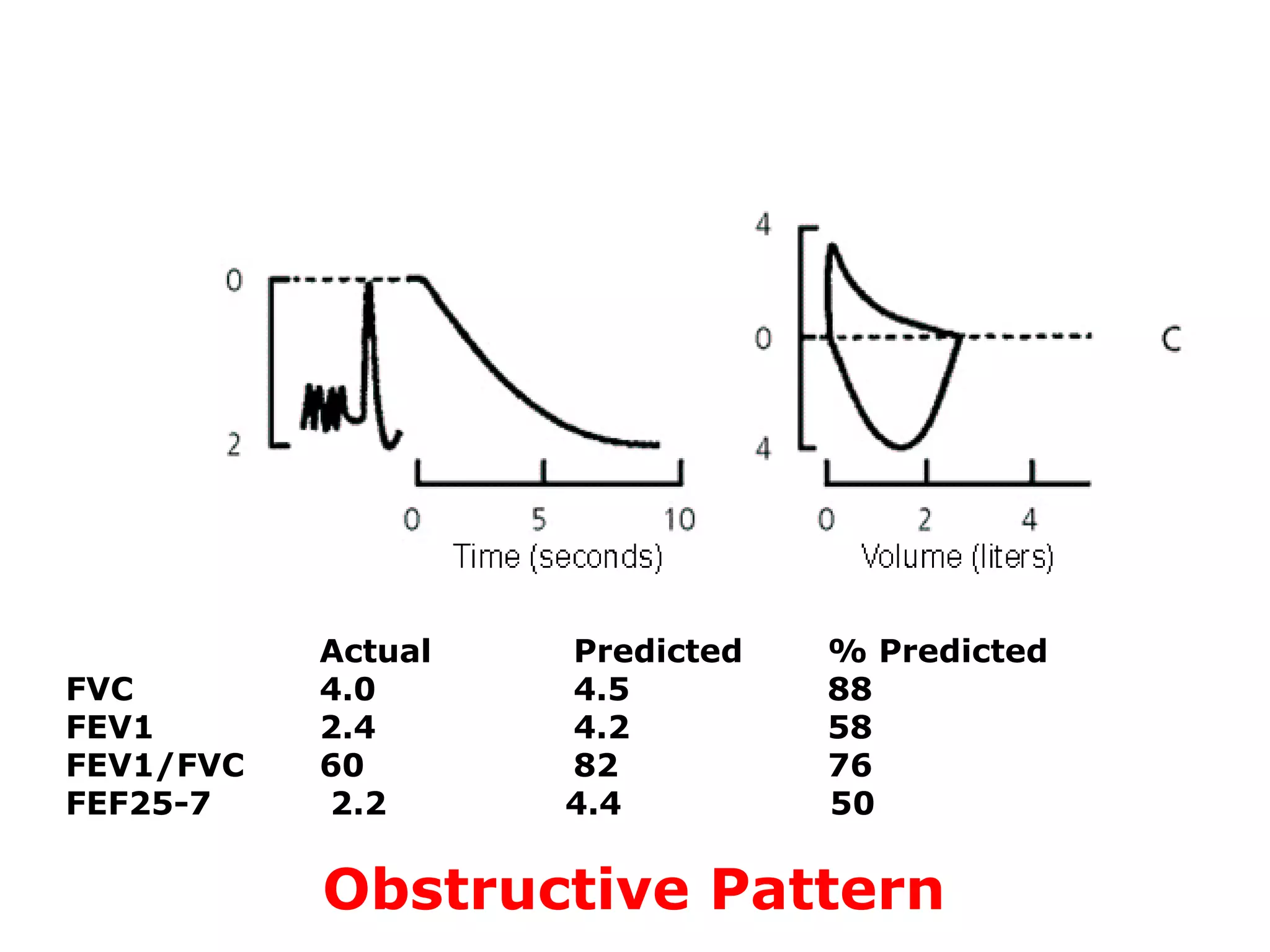 Actual Predicted % Predicted 
FVC 4.0 4.5 88 
FEV1 2.4 4.2 58 
FEV1/FVC 60 82 76 
FEF25-7 2.2 4.4 50 
Obstructive Pattern 
 