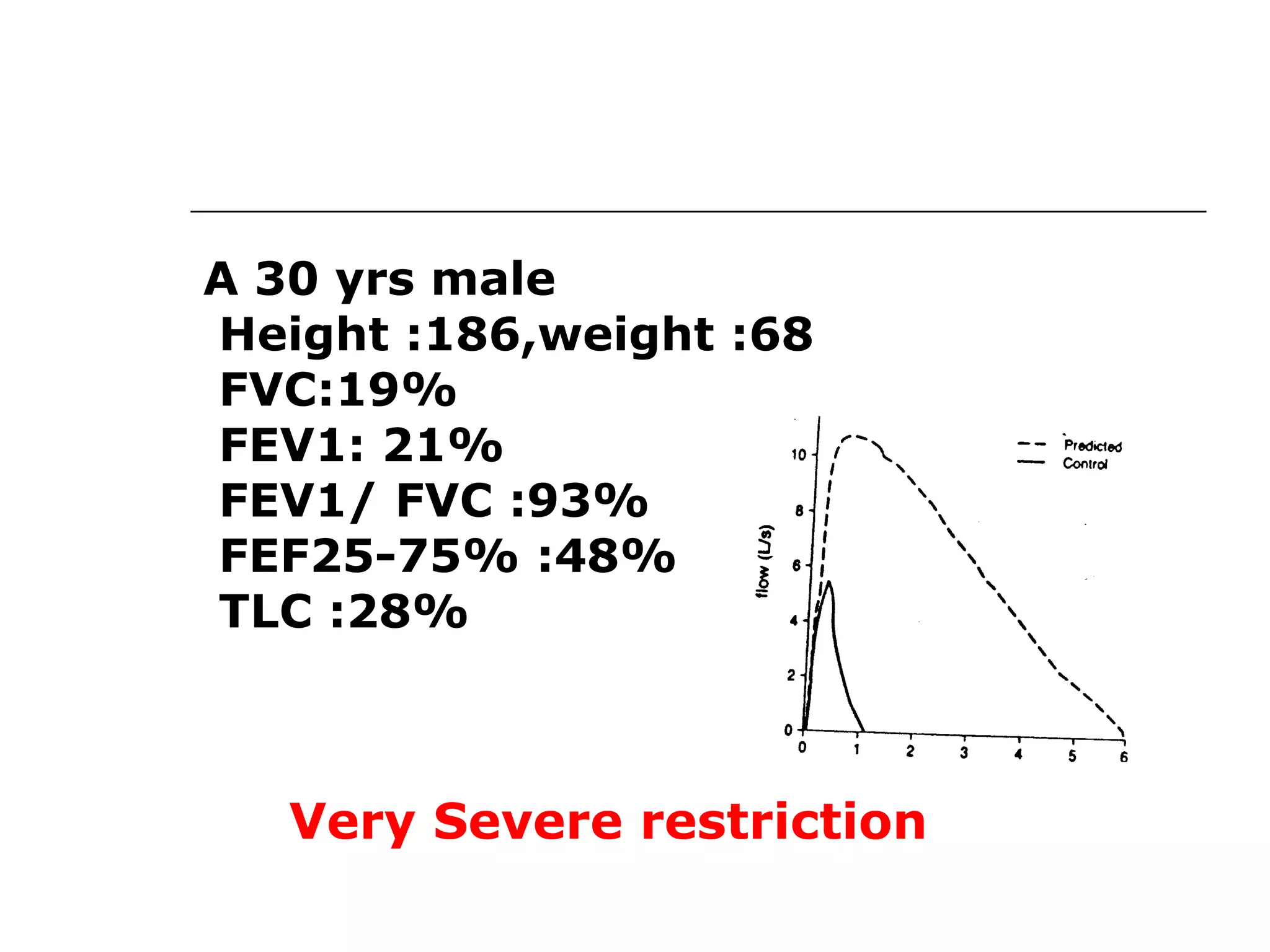 A 30 yrs male 
Height :186,weight :68 
FVC:19% 
FEV1: 21% 
FEV1/ FVC :93% 
FEF25-75% :48% 
TLC :28% 
Very Severe restriction 
 