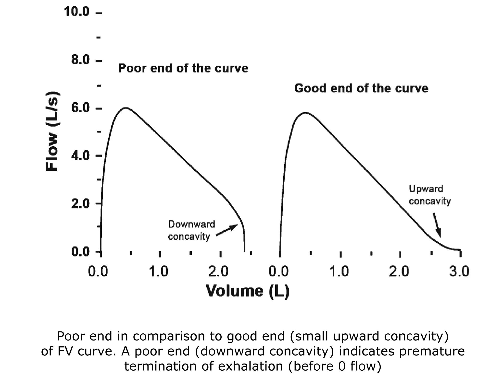 Poor end in comparison to good end (small upward concavity) 
of FV curve. A poor end (downward concavity) indicates premature 
termination of exhalation (before 0 flow) 
 