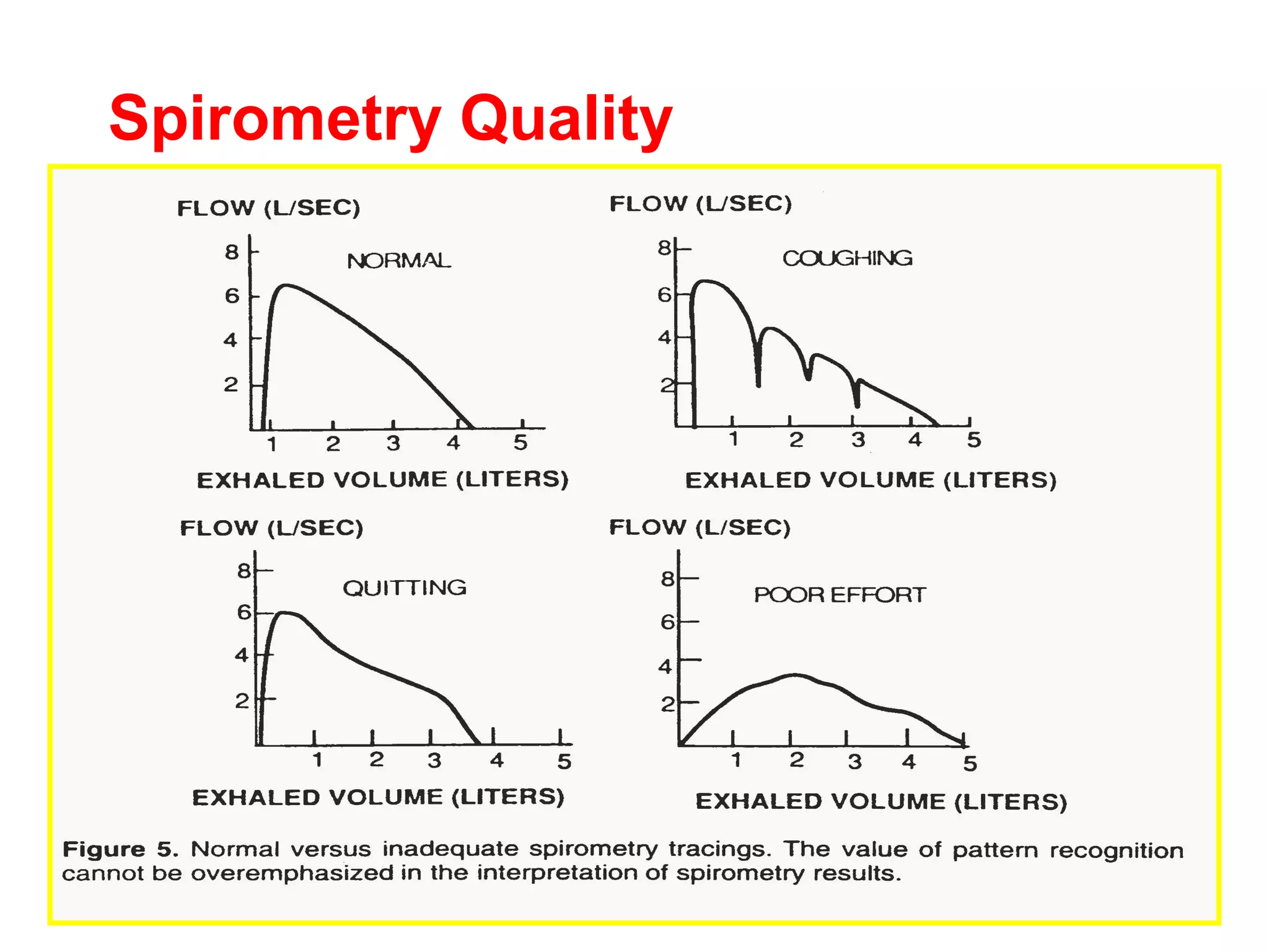 Spirometry Quality 
 