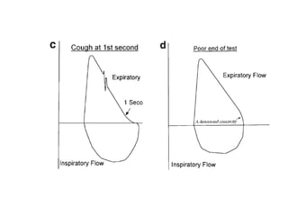 Spirometry Interpretation | PPT