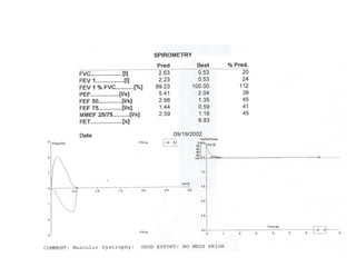 Results 
Pre-Bronchodilator Post-Bronchodilator 
Predicte 
d 
Measured % Measured % % change 
FVC 4.65 4.65 100 4.95 106 6...