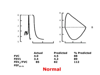 Results 
Pre-Bronchodilator Post-Bronchodilator 
Predicte 
d 
Measured % Measured % % change 
FVC 3.78 1.92 51 2.7 71 34 
...