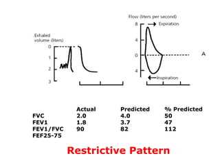 Actual Predicted % Predicted 
FVC 2.0 4.0 50 
FEV1 1.8 3.7 47 
FEV1/FVC 90 82 112 
FEF25-75 
Restrictive Pattern 
 