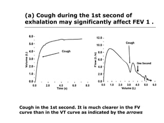 (a) Cough during the 1st second of 
exhalation may significantly affect FEV 1 . 
Cough in the 1st second. It is much clearer in the FV 
curve than in the VT curve as indicated by the arrows 
 