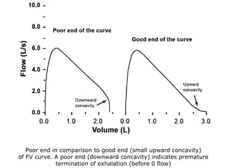 Poor end in comparison to good end (small upward concavity) 
of FV curve. A poor end (downward concavity) indicates premature 
termination of exhalation (before 0 flow) 
 
