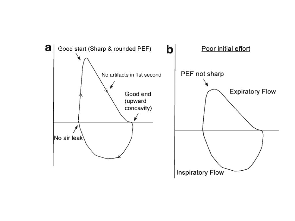 Spirometry Interpretation