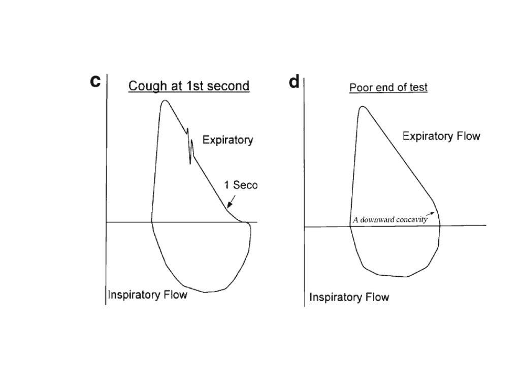 Spirometry Interpretation
