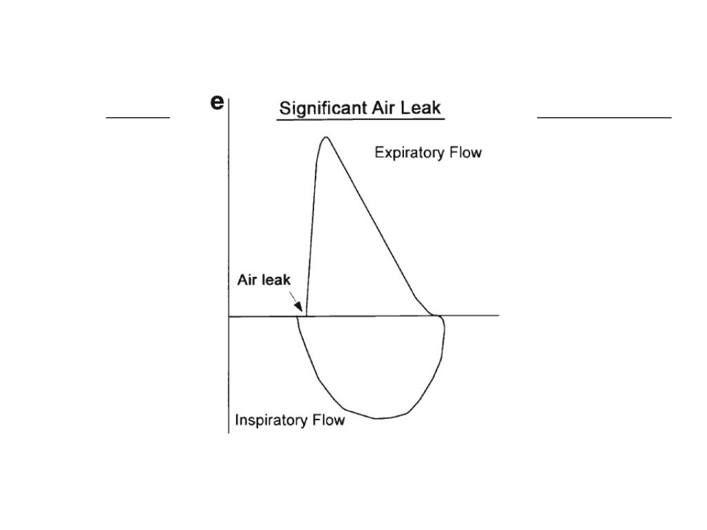 Spirometry Interpretation