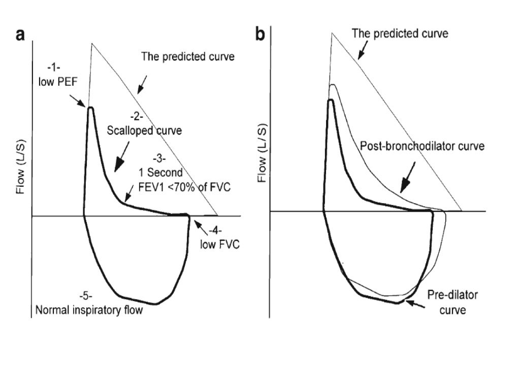 Spirometry Interpretation