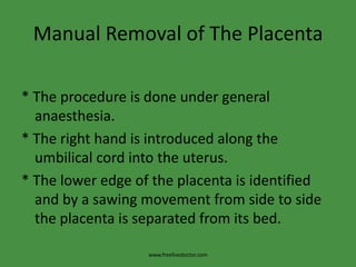Manual Removal of The Placenta* The procedure is done under general anaesthesia.* The right hand is introduced along the umbilical cord into the uterus.* The lower edge of the placenta is identified and by a sawing movement from side to side the placenta is separated from its bed.www.freelivedoctor.com