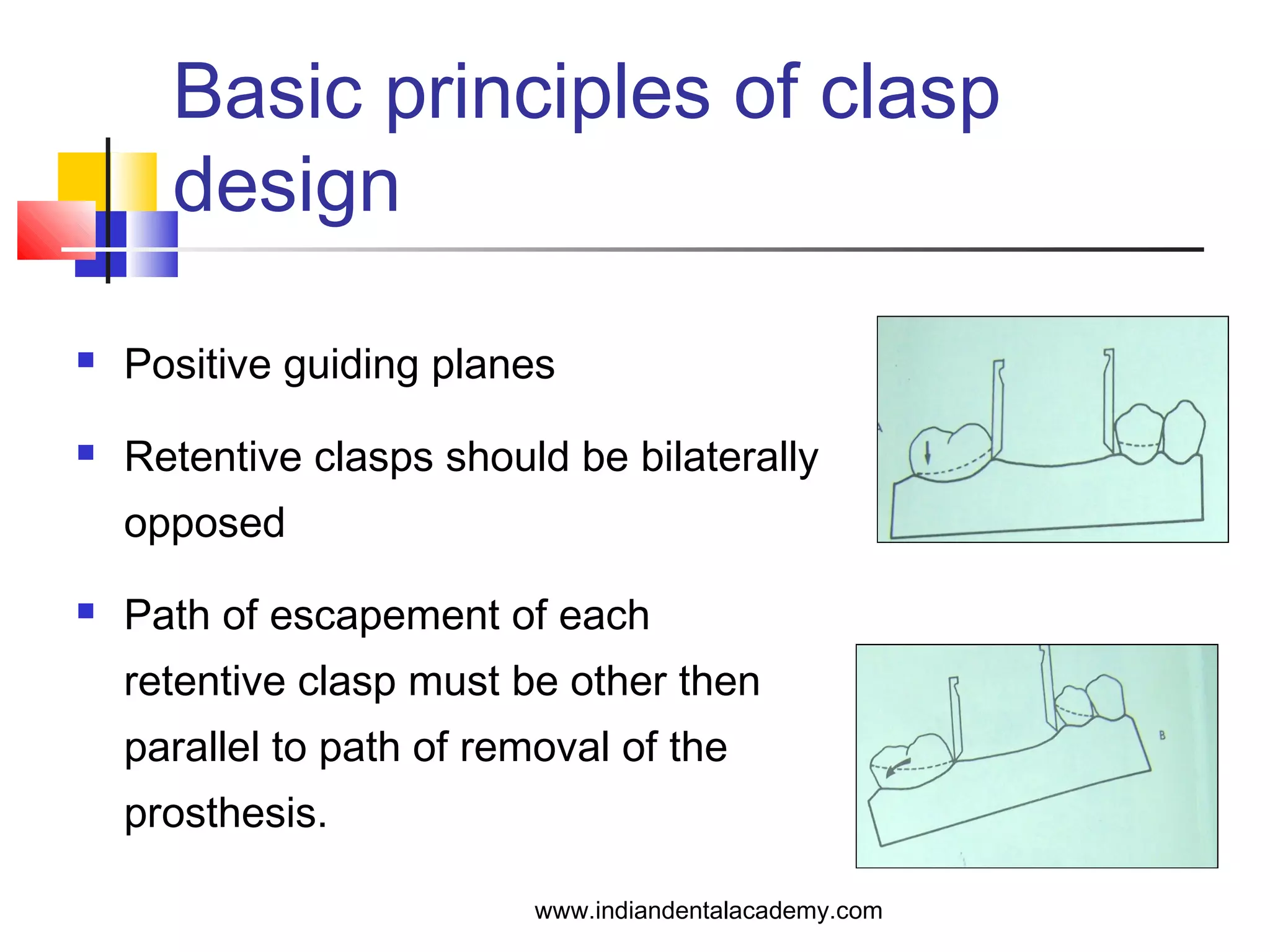 Basic principles of clasp
design
 Positive guiding planes
 Retentive clasps should be bilaterally
opposed
 Path of escapement of each
retentive clasp must be other then
parallel to path of removal of the
prosthesis.
www.indiandentalacademy.com
 