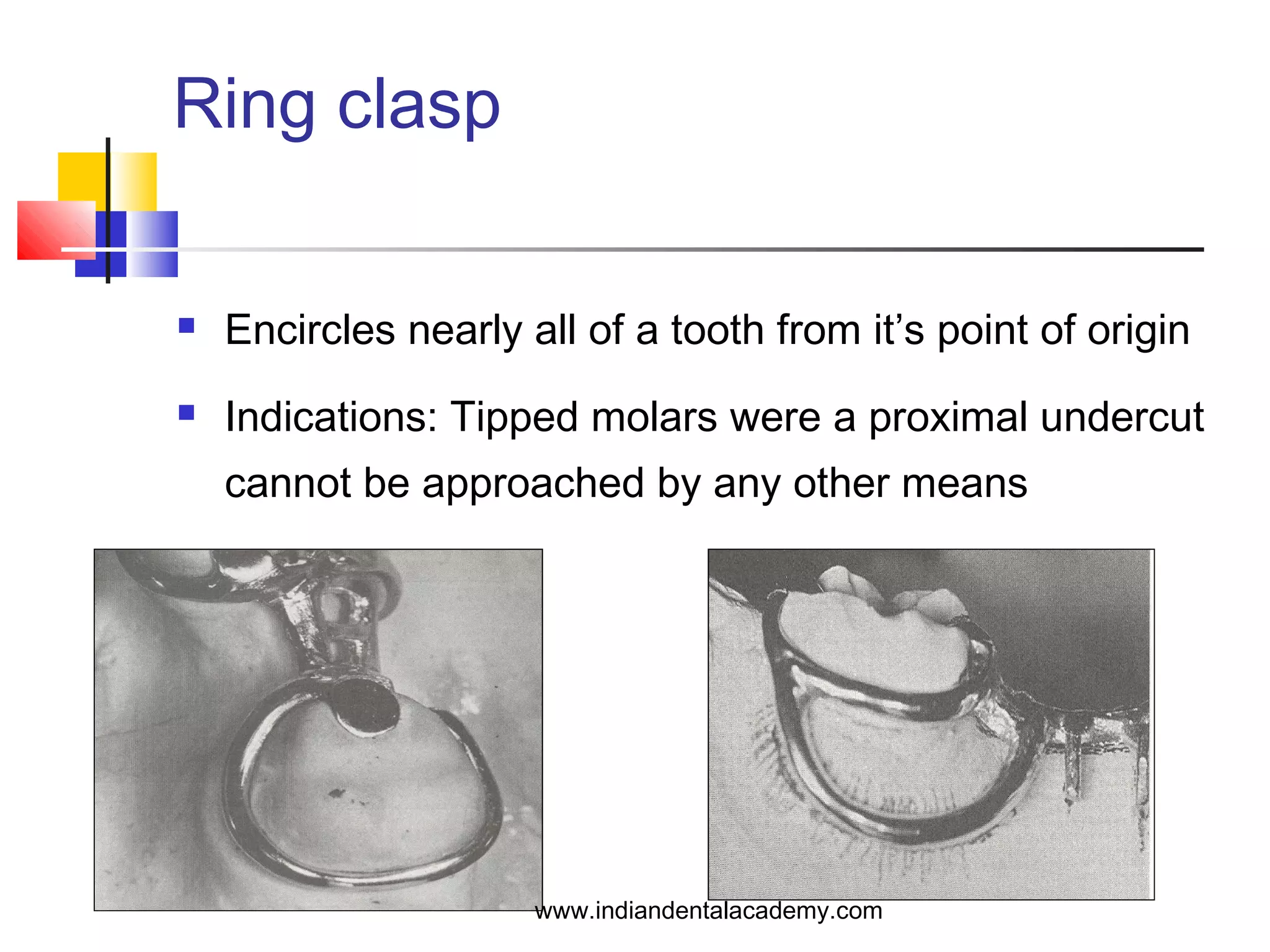 Ring clasp
 Encircles nearly all of a tooth from it’s point of origin
 Indications: Tipped molars were a proximal undercut
cannot be approached by any other means
www.indiandentalacademy.com
 