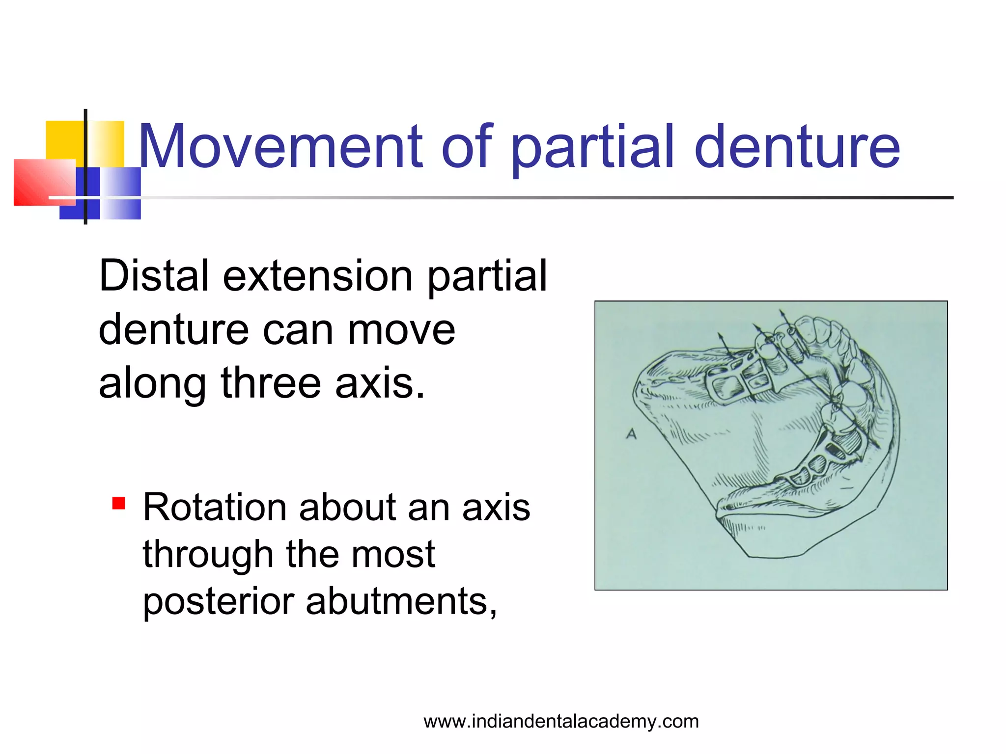 Movement of partial denture
Distal extension partial
denture can move
along three axis.
 Rotation about an axis
through the most
posterior abutments,
www.indiandentalacademy.com
 