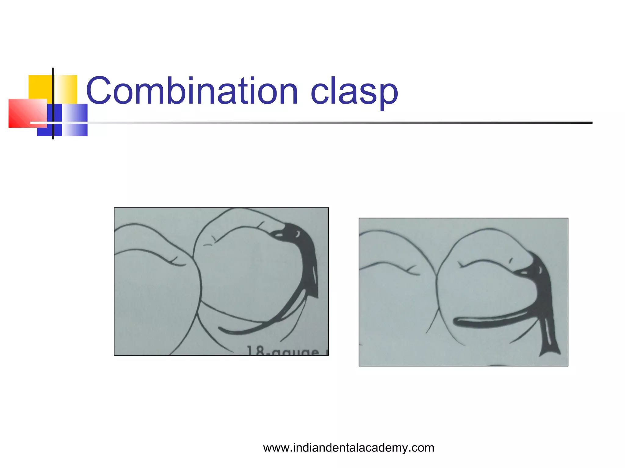 Combination clasp
www.indiandentalacademy.com
 