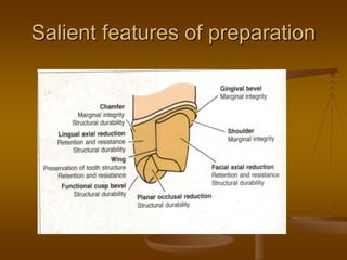 Salient features of preparation
 