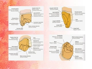 Pin Ledge Direct and indirect retainers in fixed denture prosthodontics | PPT
