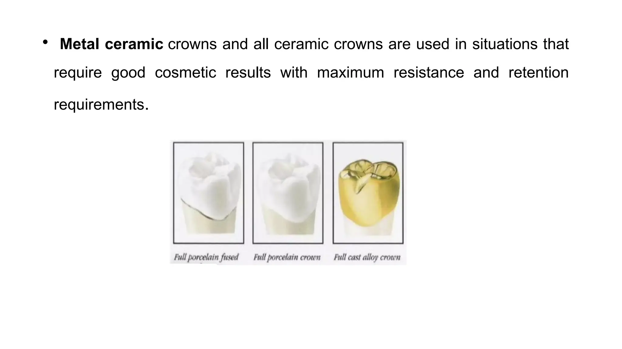 • Metal ceramic crowns and all ceramic crowns are used in situations that
require good cosmetic results with maximum resistance and retention
requirements.
 