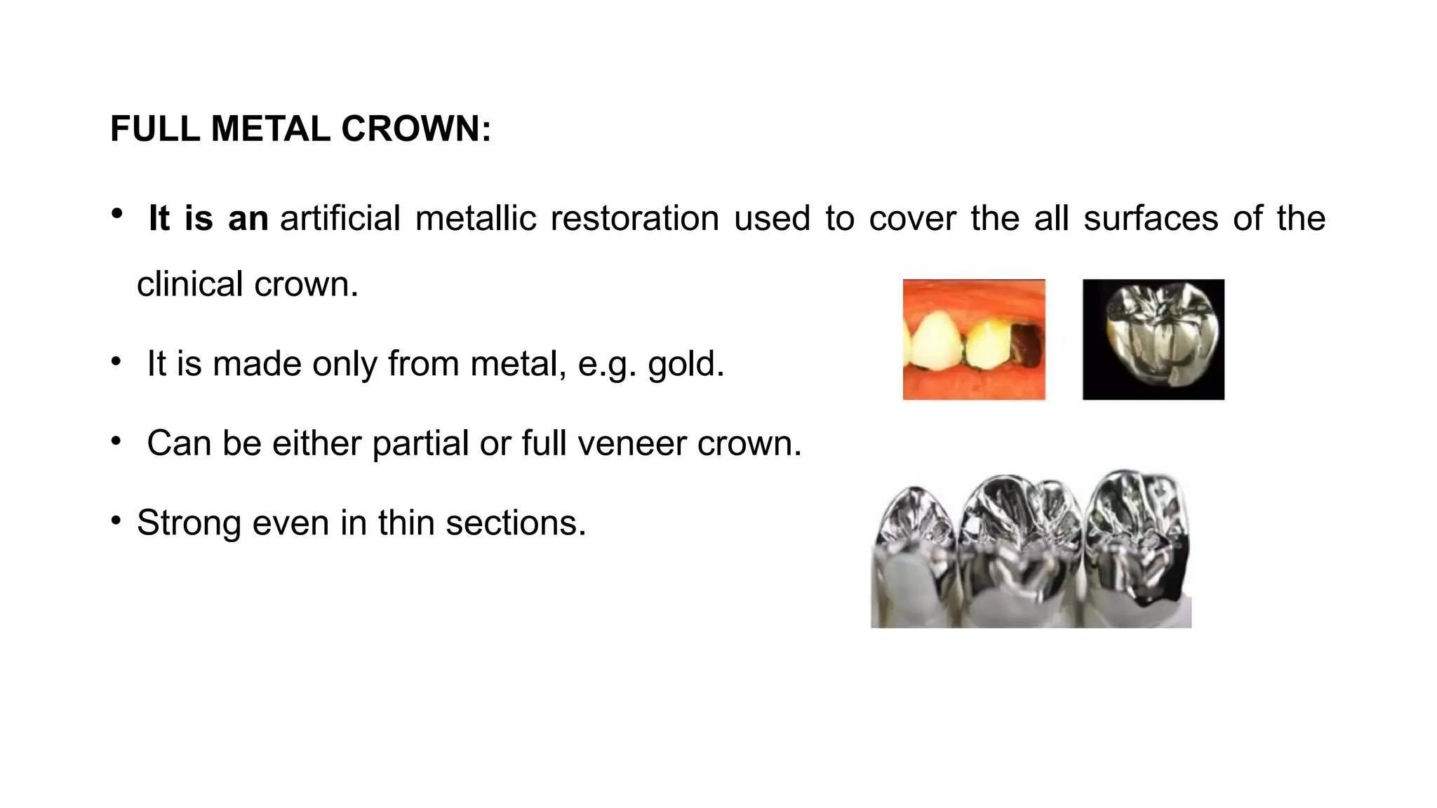 FULL METAL CROWN:
• It is an artificial metallic restoration used to cover the all surfaces of the
clinical crown.
• It is made only from metal, e.g. gold.
• Can be either partial or full veneer crown.
• Strong even in thin sections.
 