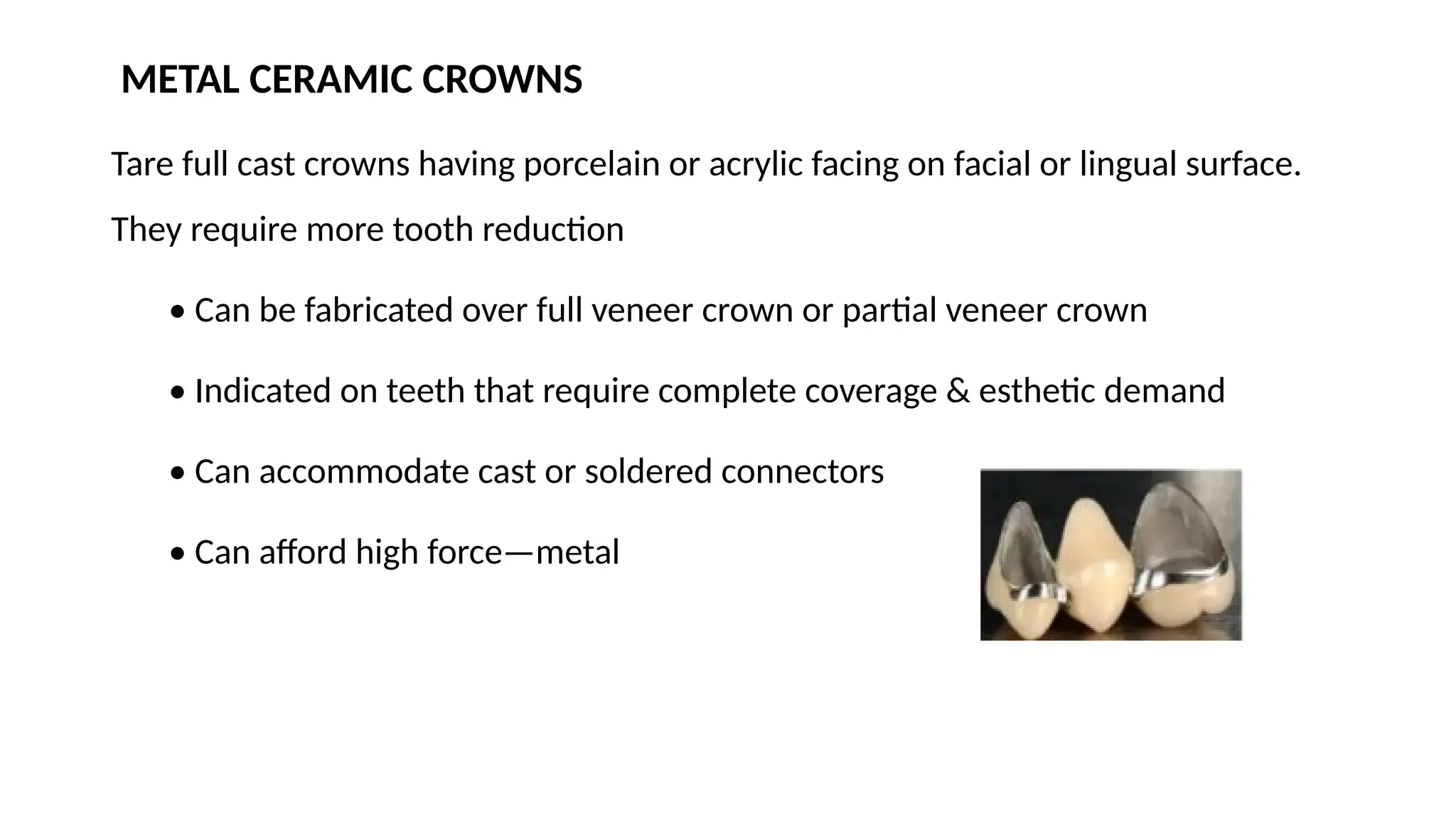 METAL CERAMIC CROWNS
Tare full cast crowns having porcelain or acrylic facing on facial or lingual surface.
They require more tooth reduction
• Can be fabricated over full veneer crown or partial veneer crown
• Indicated on teeth that require complete coverage & esthetic demand
• Can accommodate cast or soldered connectors
• Can afford high force—metal
 