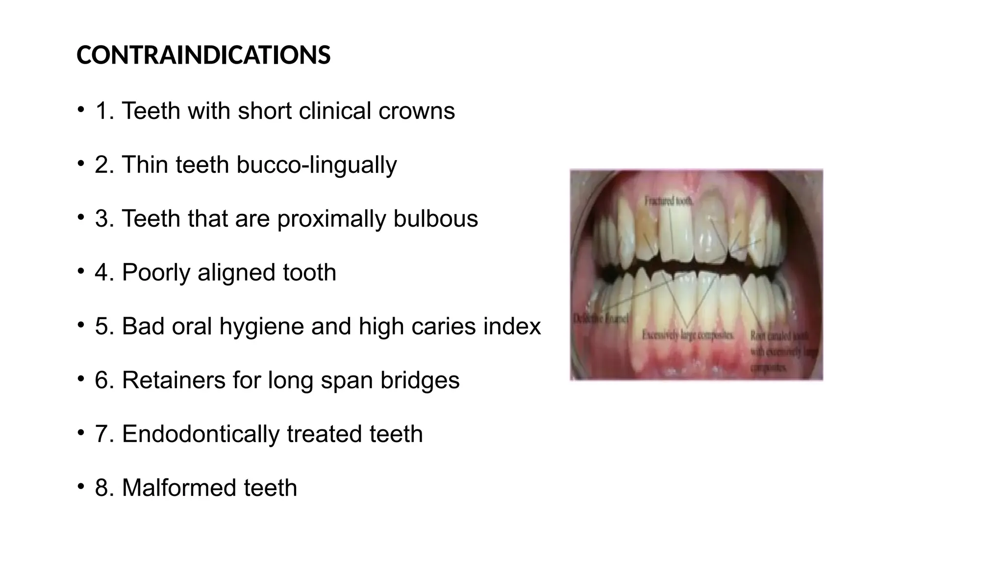 CONTRAINDICATIONS
• 1. Teeth with short clinical crowns
• 2. Thin teeth bucco-lingually
• 3. Teeth that are proximally bulbous
• 4. Poorly aligned tooth
• 5. Bad oral hygiene and high caries index
• 6. Retainers for long span bridges
• 7. Endodontically treated teeth
• 8. Malformed teeth
 