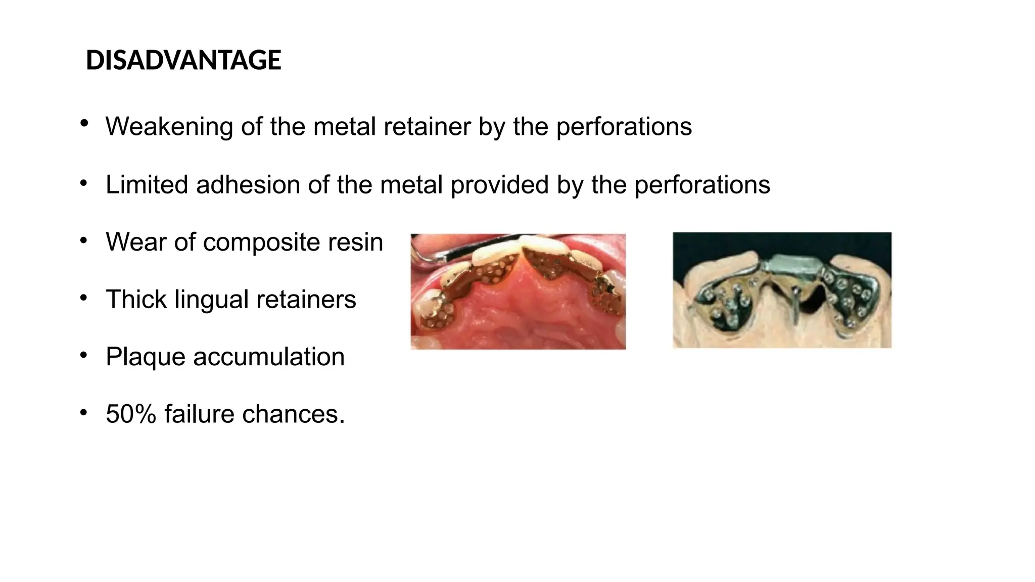DISADVANTAGE
• Weakening of the metal retainer by the perforations
• Limited adhesion of the metal provided by the perforations
• Wear of composite resin
• Thick lingual retainers
• Plaque accumulation
• 50% failure chances.
 