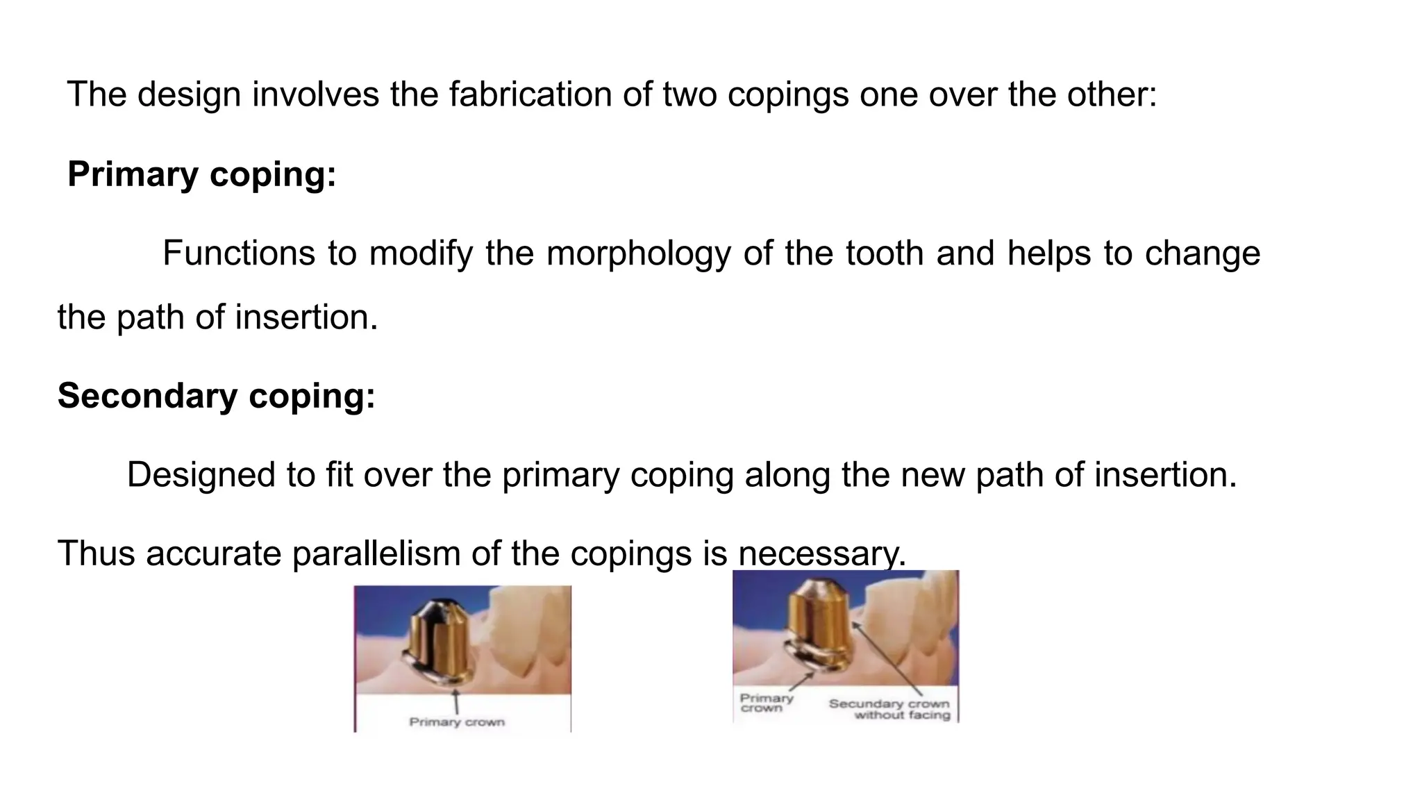 The design involves the fabrication of two copings one over the other:
Primary coping:
Functions to modify the morphology of the tooth and helps to change
the path of insertion.
Secondary coping:
Designed to fit over the primary coping along the new path of insertion.
Thus accurate parallelism of the copings is necessary.
 