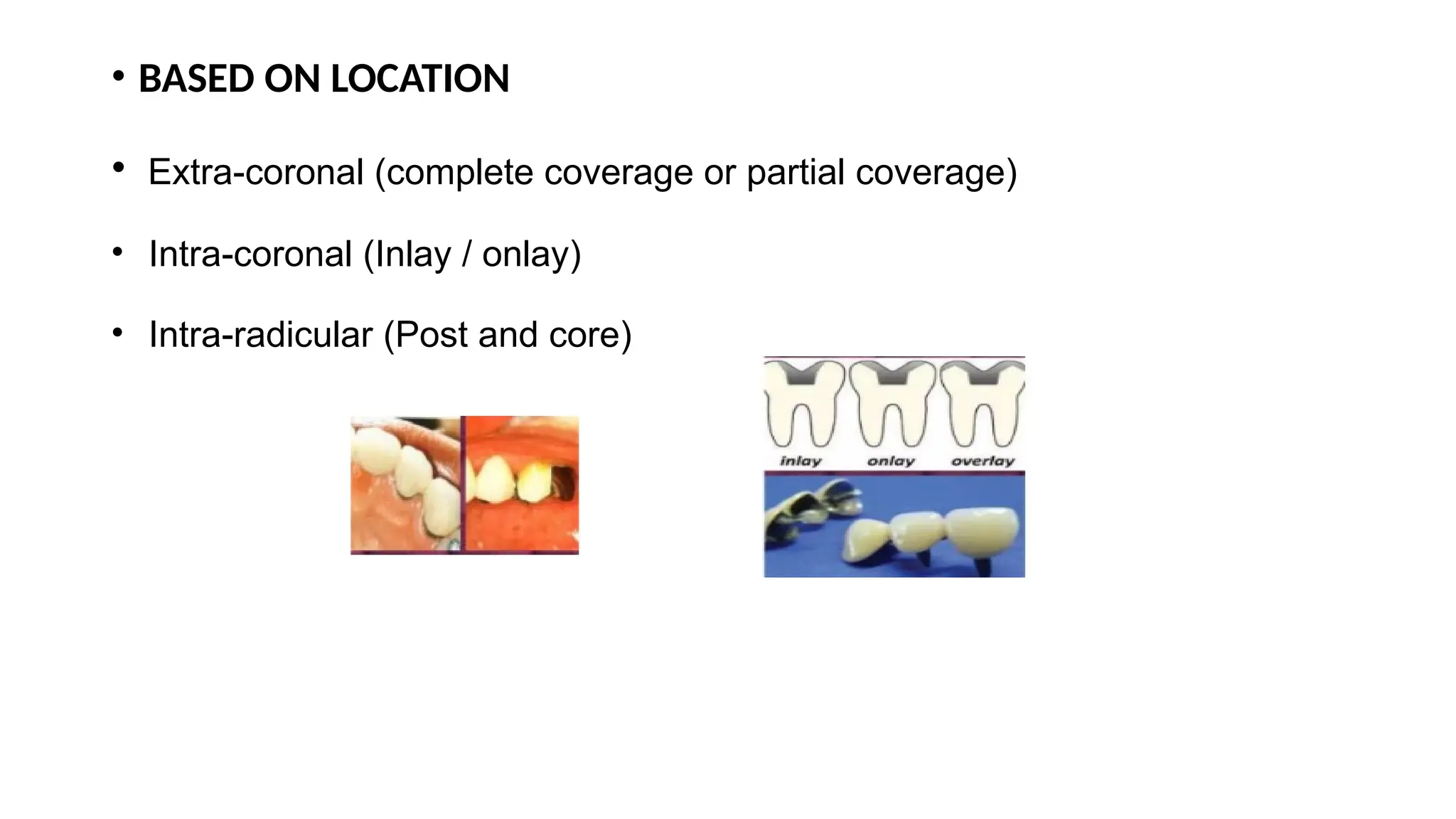 • BASED ON LOCATION
• Extra-coronal (complete coverage or partial coverage)
• Intra-coronal (Inlay / onlay)
• Intra-radicular (Post and core)
 