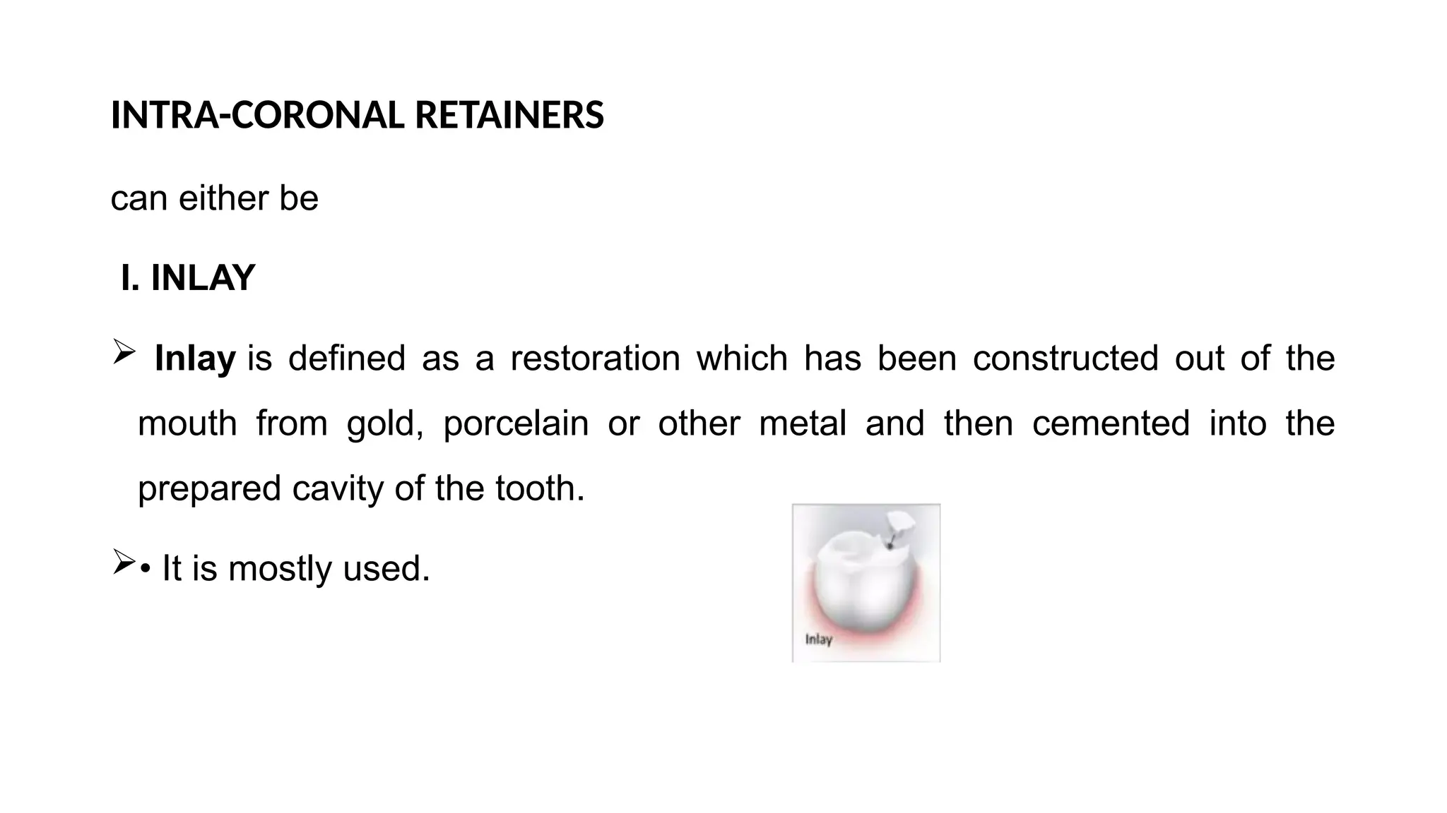 INTRA-CORONAL RETAINERS
can either be
I. INLAY
 Inlay is defined as a restoration which has been constructed out of the
mouth from gold, porcelain or other metal and then cemented into the
prepared cavity of the tooth.
• It is mostly used.
 