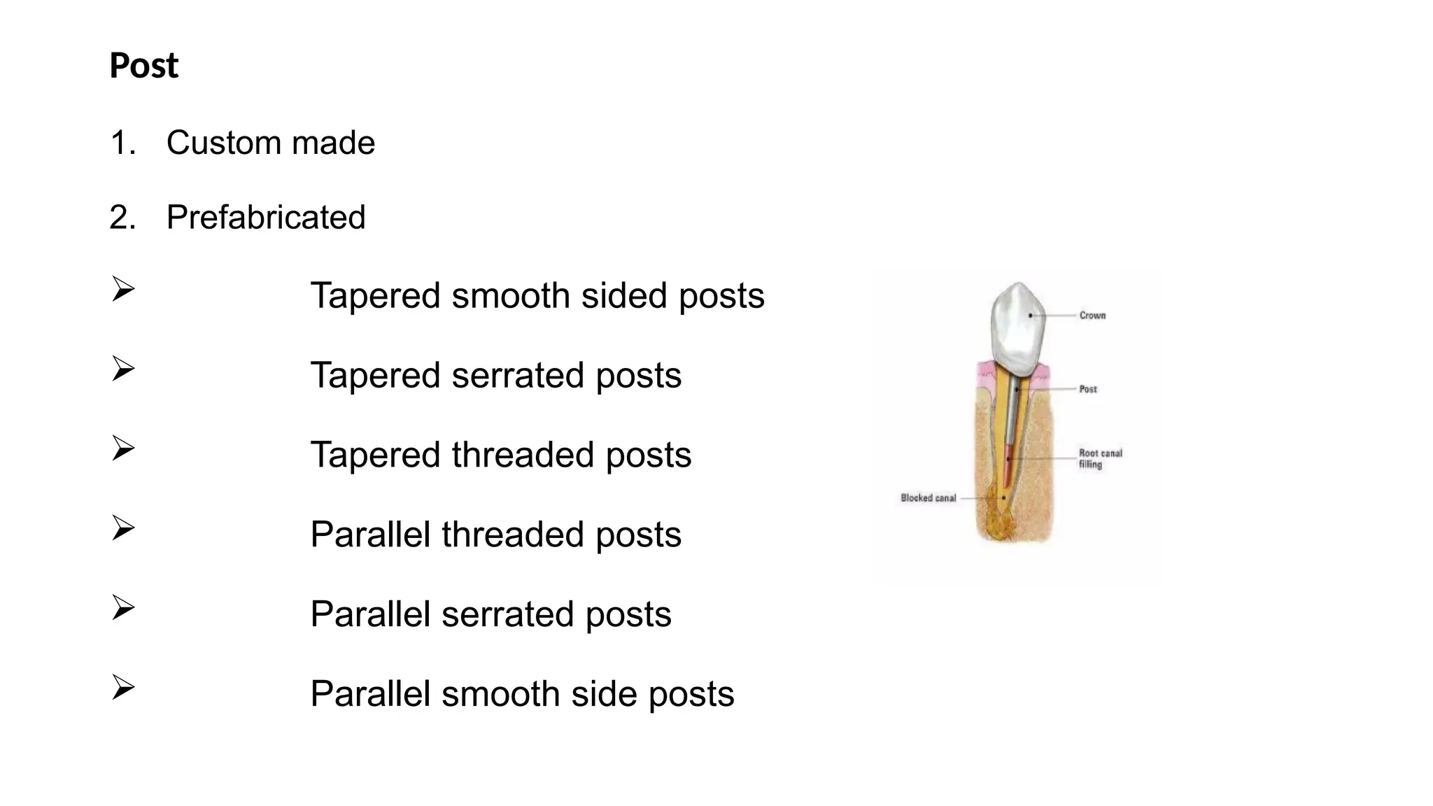 Post
1. Custom made
2. Prefabricated
 Tapered smooth sided posts
 Tapered serrated posts
 Tapered threaded posts
 Parallel threaded posts
 Parallel serrated posts
 Parallel smooth side posts
 