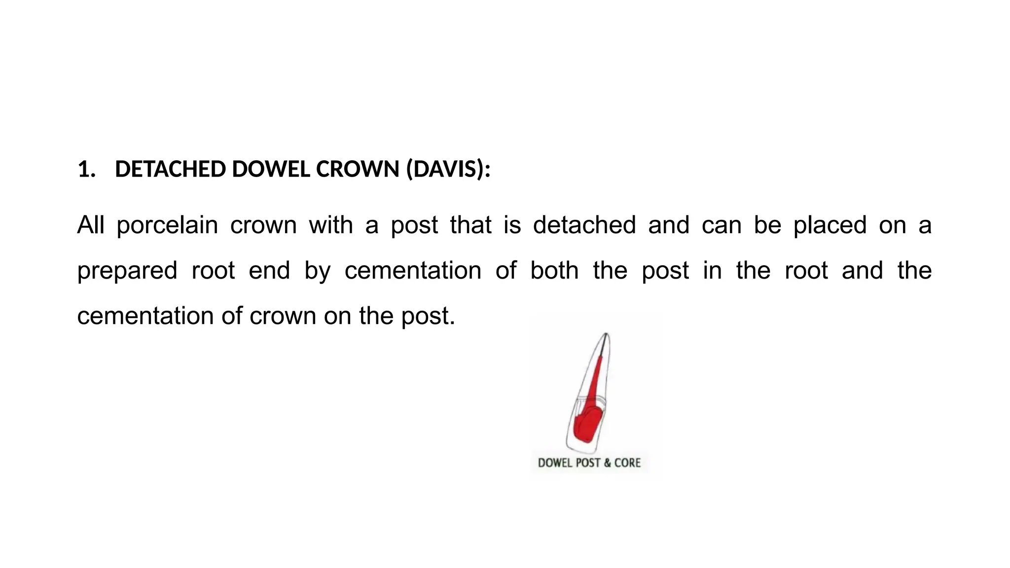 1. DETACHED DOWEL CROWN (DAVIS):
All porcelain crown with a post that is detached and can be placed on a
prepared root end by cementation of both the post in the root and the
cementation of crown on the post.
 